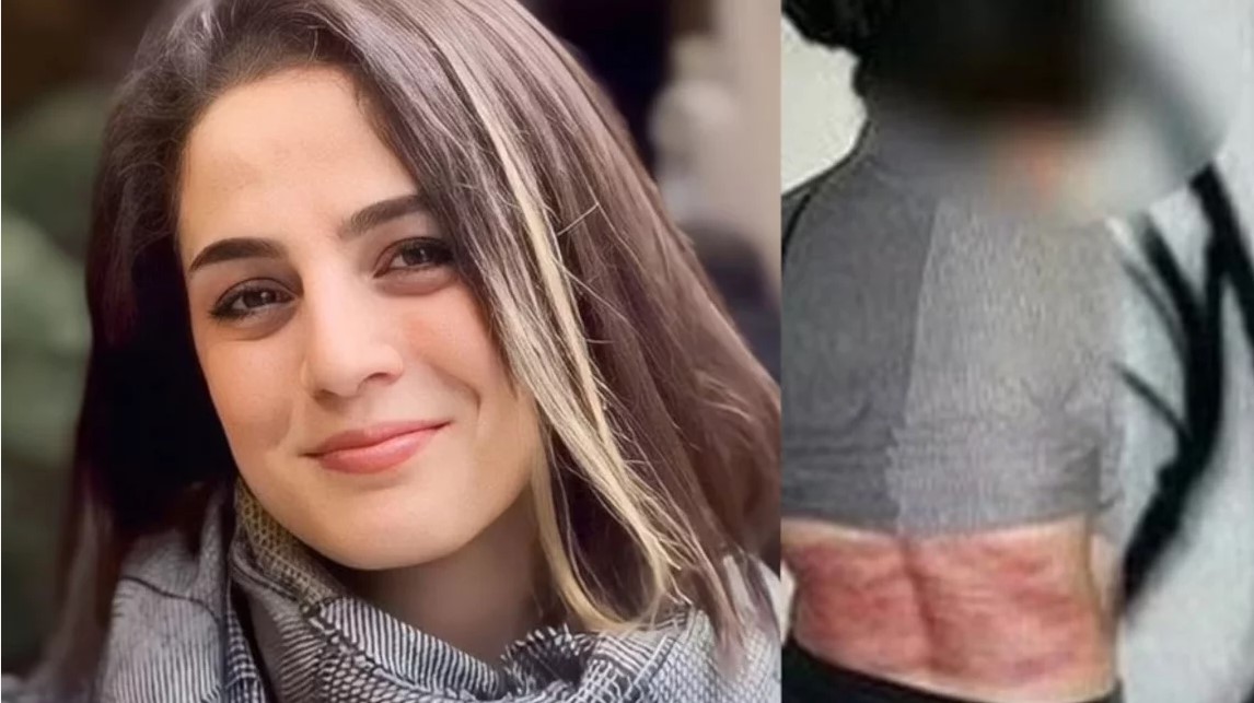 Ιράν: H 33χρονη ηρωίδα που τη μαστίγωσαν 74 φορές γιατί δεν φορούσε μαντίλα