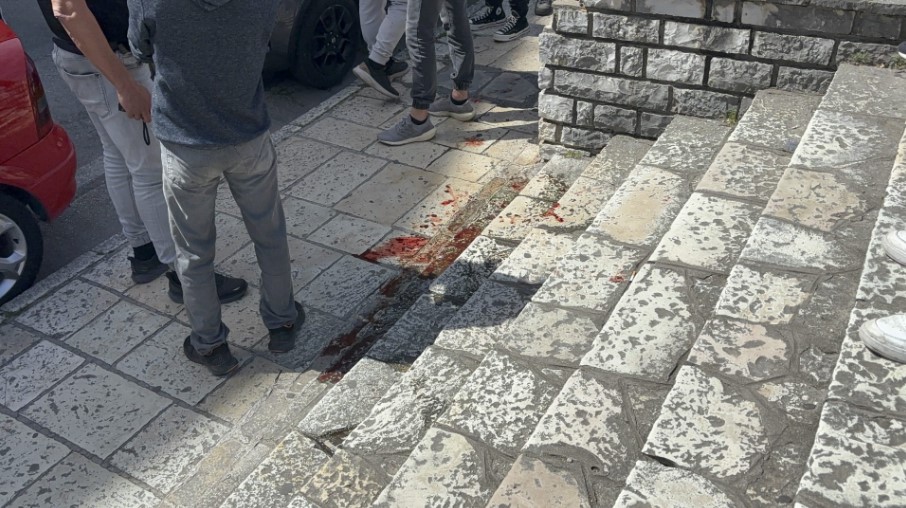 Αιματηρή συμπλοκή στην Κέρκυρα: Μαθητής επιτέθηκε με μαχαίρι σε δύο ανήλικους και έναν 49χρονο