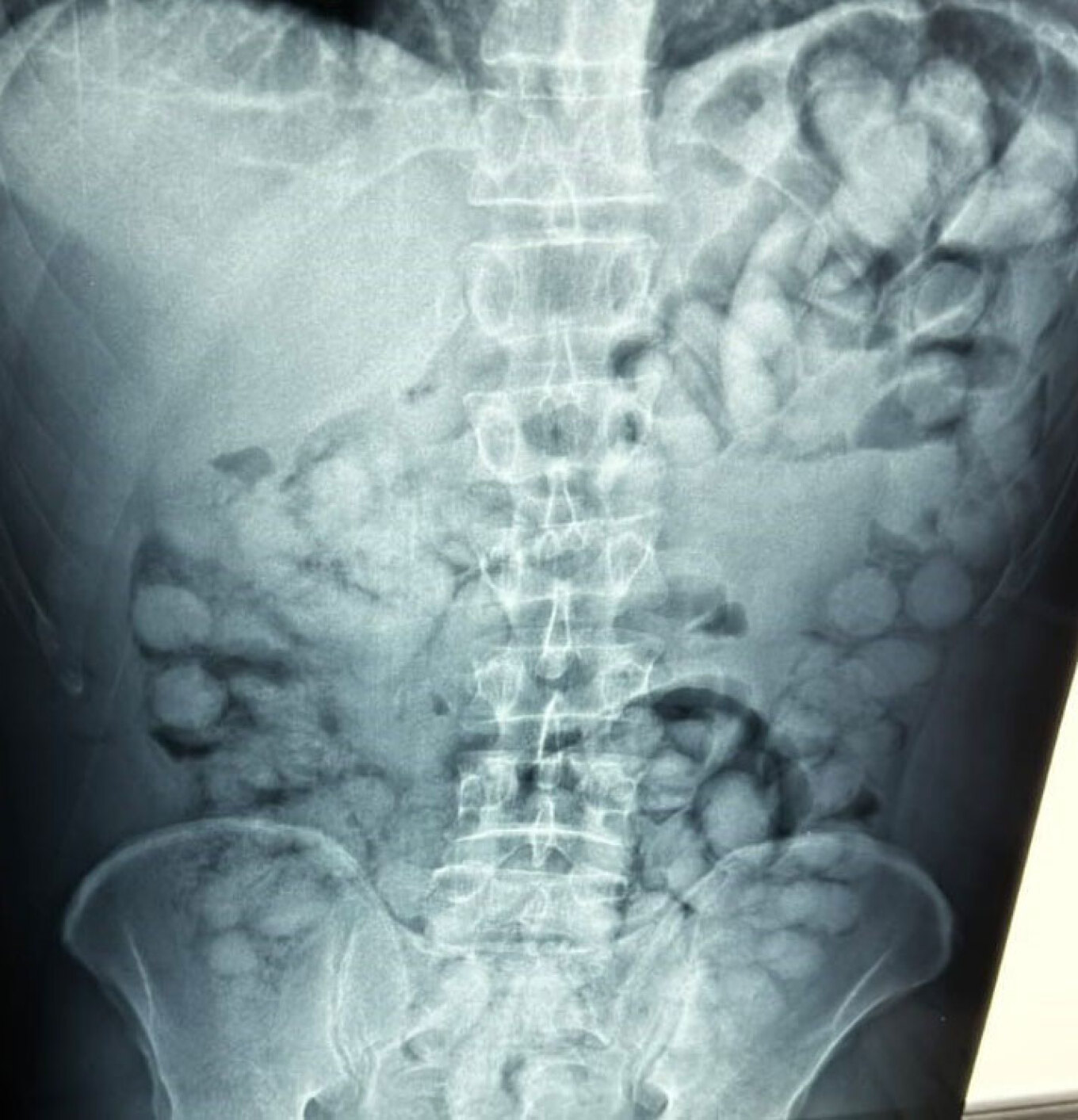 Συνελήφθη άνδρας στο αεροδρόμιο «Ελευθέριος Βενιζέλος»