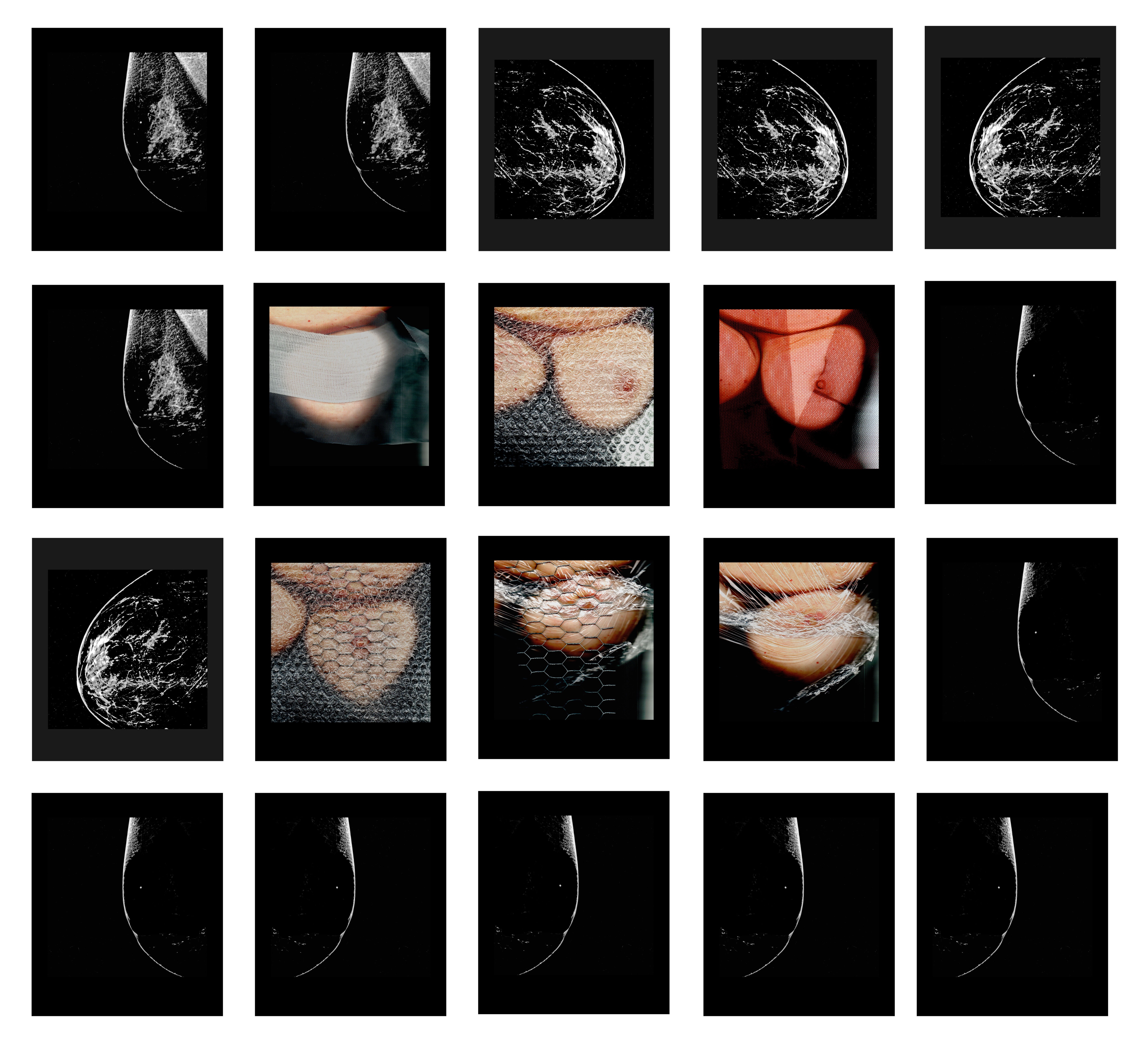 Ομαδική Εικαστική Έκθεση: Μαστογραφίες